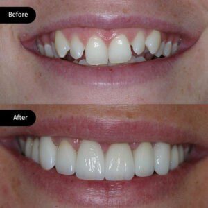 before-after-big-3-300x300